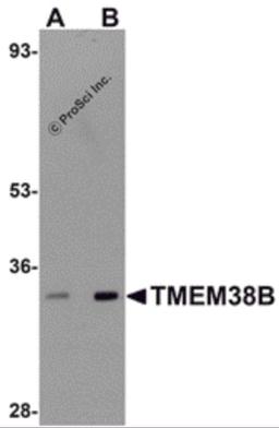 Western blot analysis of TMEM38B in rat thymus tissue lysate with TMEM38B antibody at (A) 1 and (B) 2 &#956;g/mL.