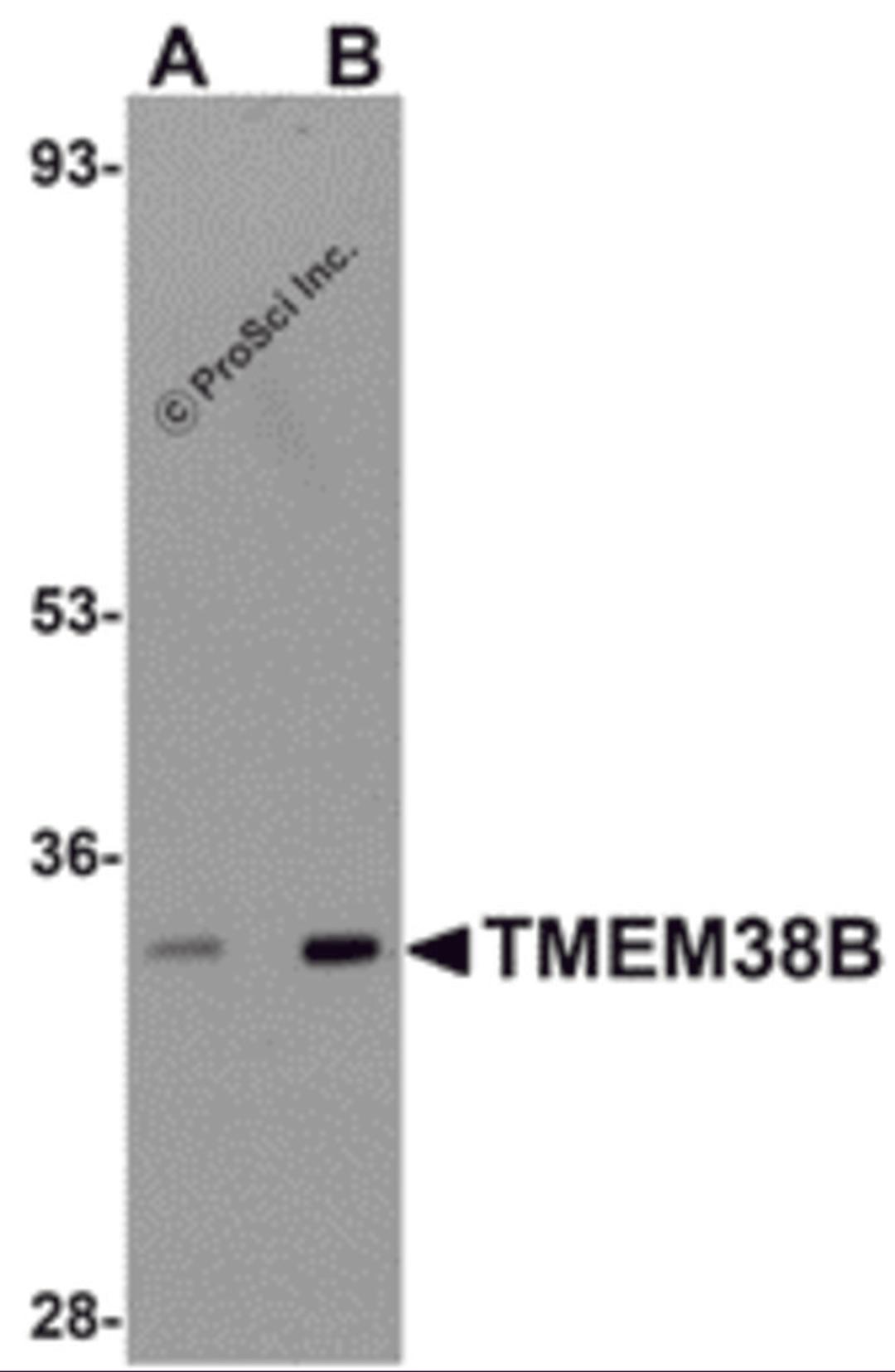 Western blot analysis of TMEM38B in rat thymus tissue lysate with TMEM38B antibody at (A) 1 and (B) 2 μg/mL.