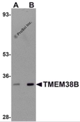 Western blot analysis of TMEM38B in rat thymus tissue lysate with TMEM38B antibody at (A) 1 and (B) 2 μg/mL.