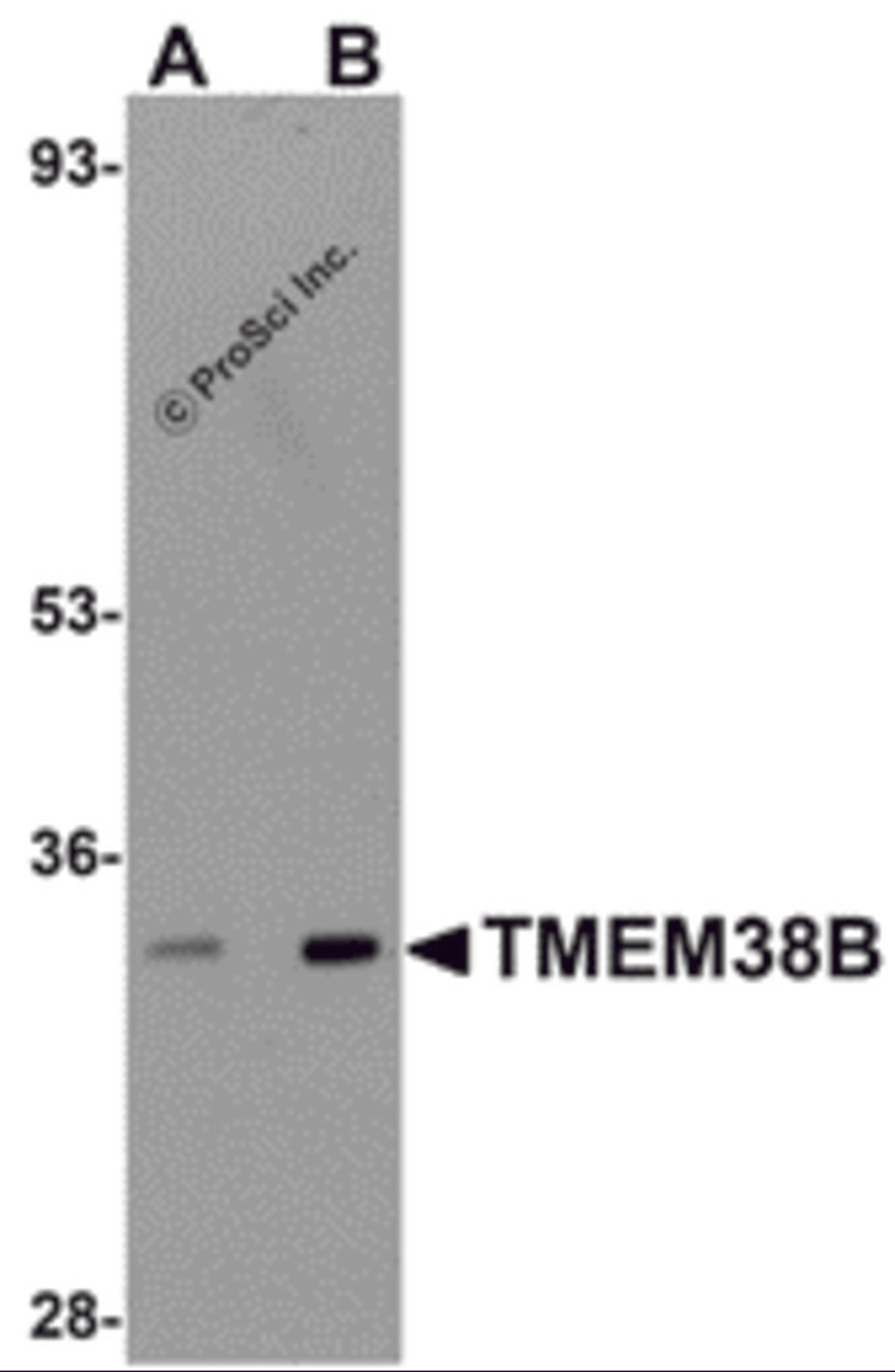 Western blot analysis of TMEM38B in rat thymus tissue lysate with TMEM38B antibody at (A) 1 and (B) 2 μg/mL.