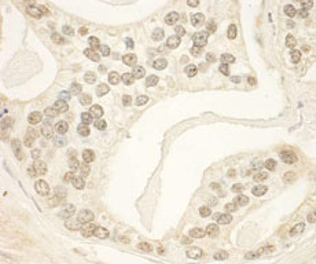 Detection of human PHF23 by immunohistochemistry.