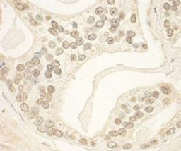 Detection of human PHF23 by immunohistochemistry.