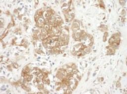 Detection of human Cortactin by immunohistochemistry.