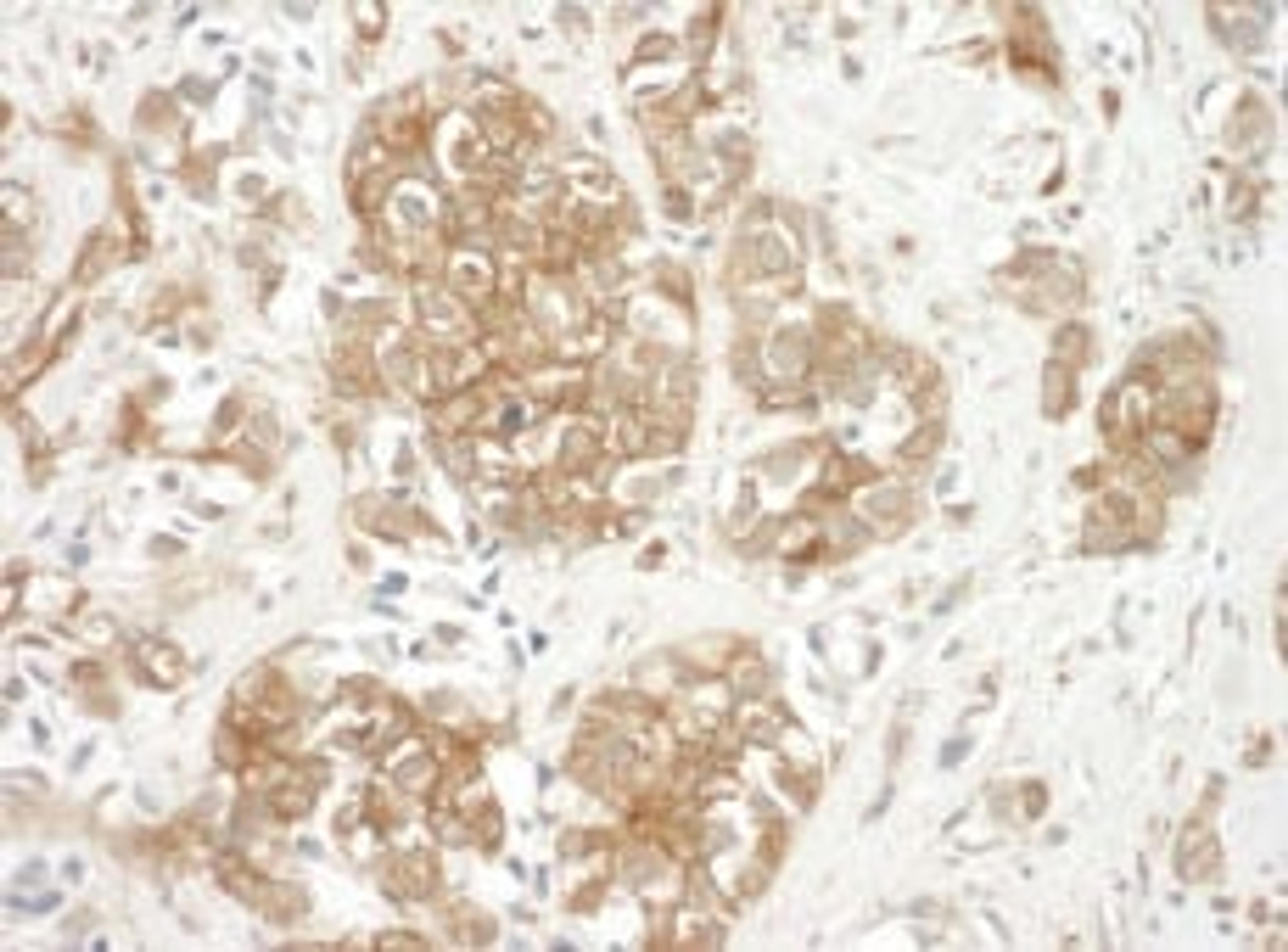 Detection of human Cortactin by immunohistochemistry.