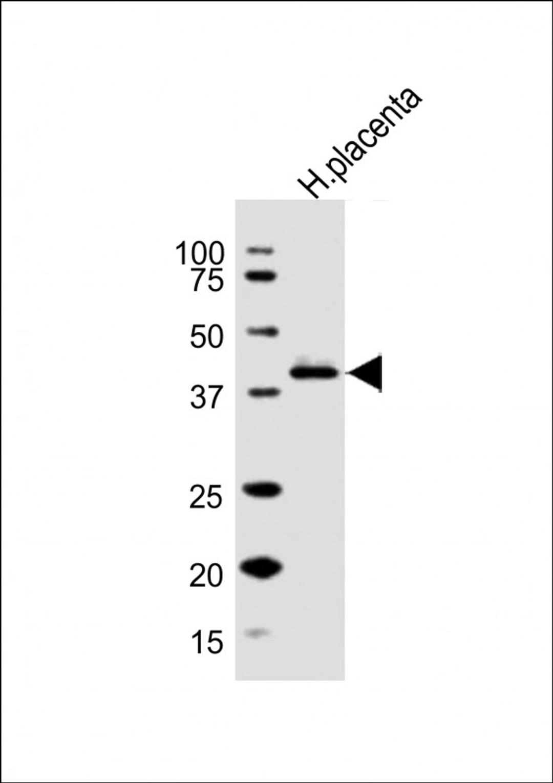 Western Blot at 1:1000 dilution + human placenta lysate Lysates/proteins at 20 ug per lane.