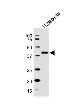 Western Blot at 1:1000 dilution + human placenta lysate Lysates/proteins at 20 ug per lane.