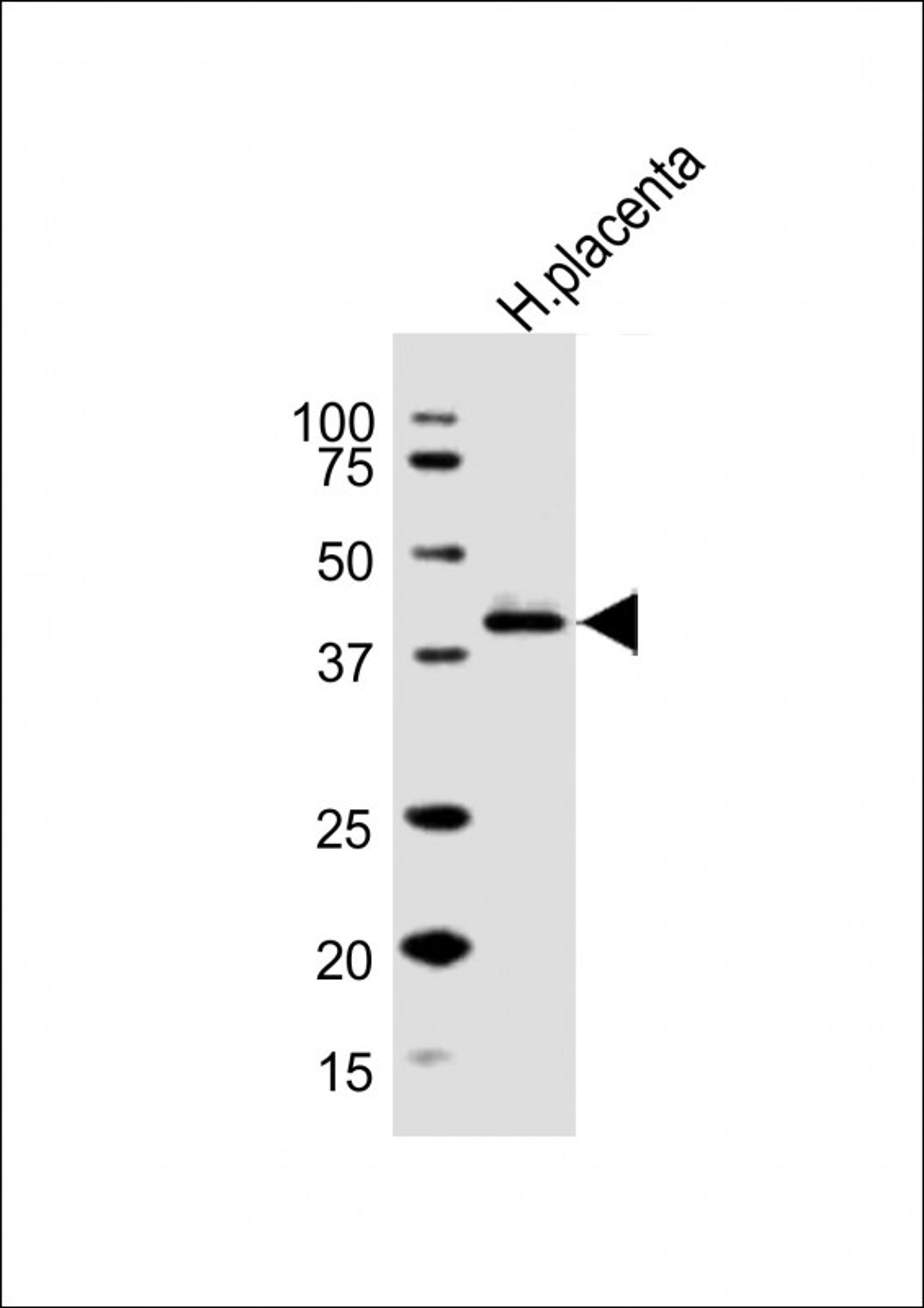 Western Blot at 1:1000 dilution + human placenta lysate Lysates/proteins at 20 ug per lane.