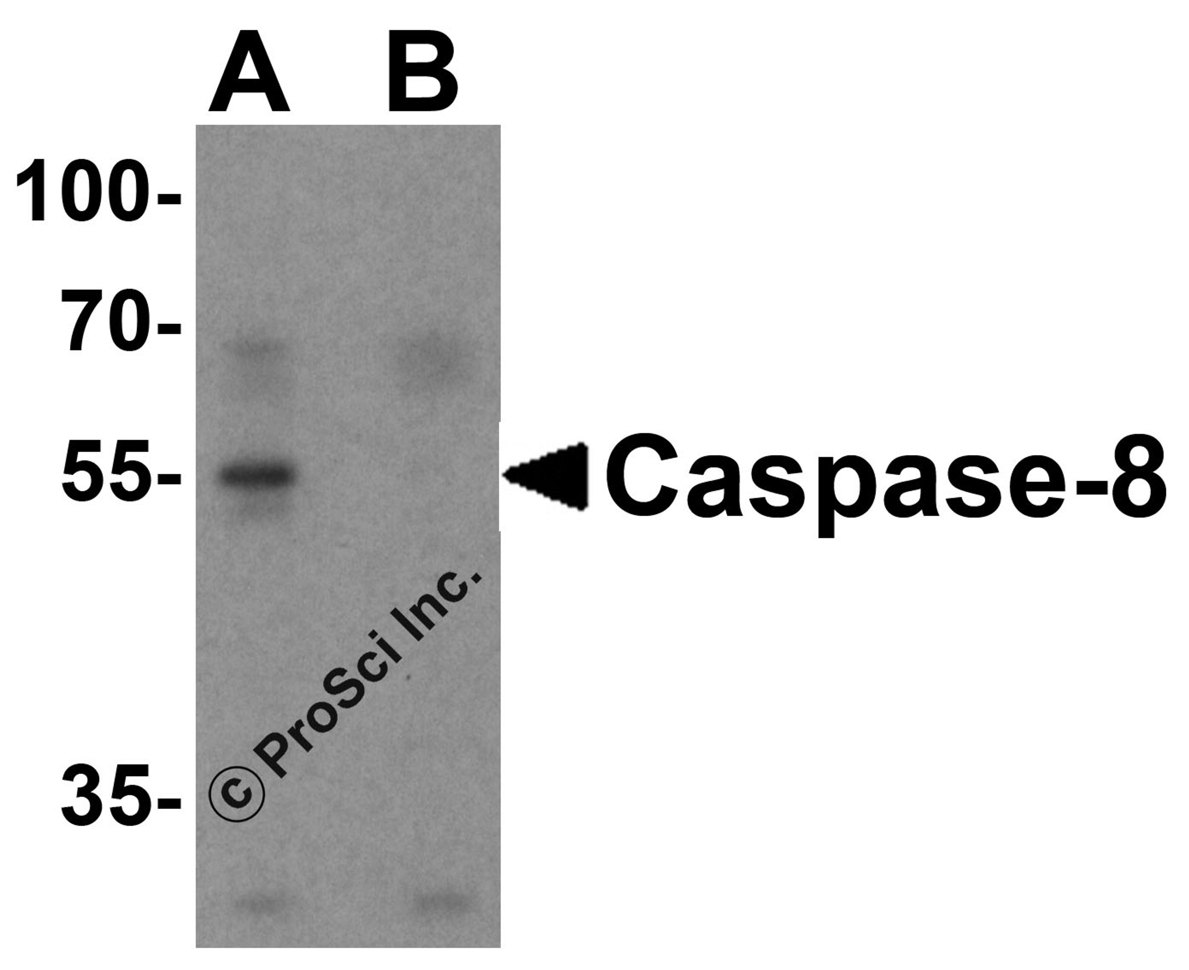 Western blot analysis of caspase-8 in Jurkat cell lysate with caspase-8 antibody at 1 μg/mL in (A) the absence and (B) the presence of blocking peptide.