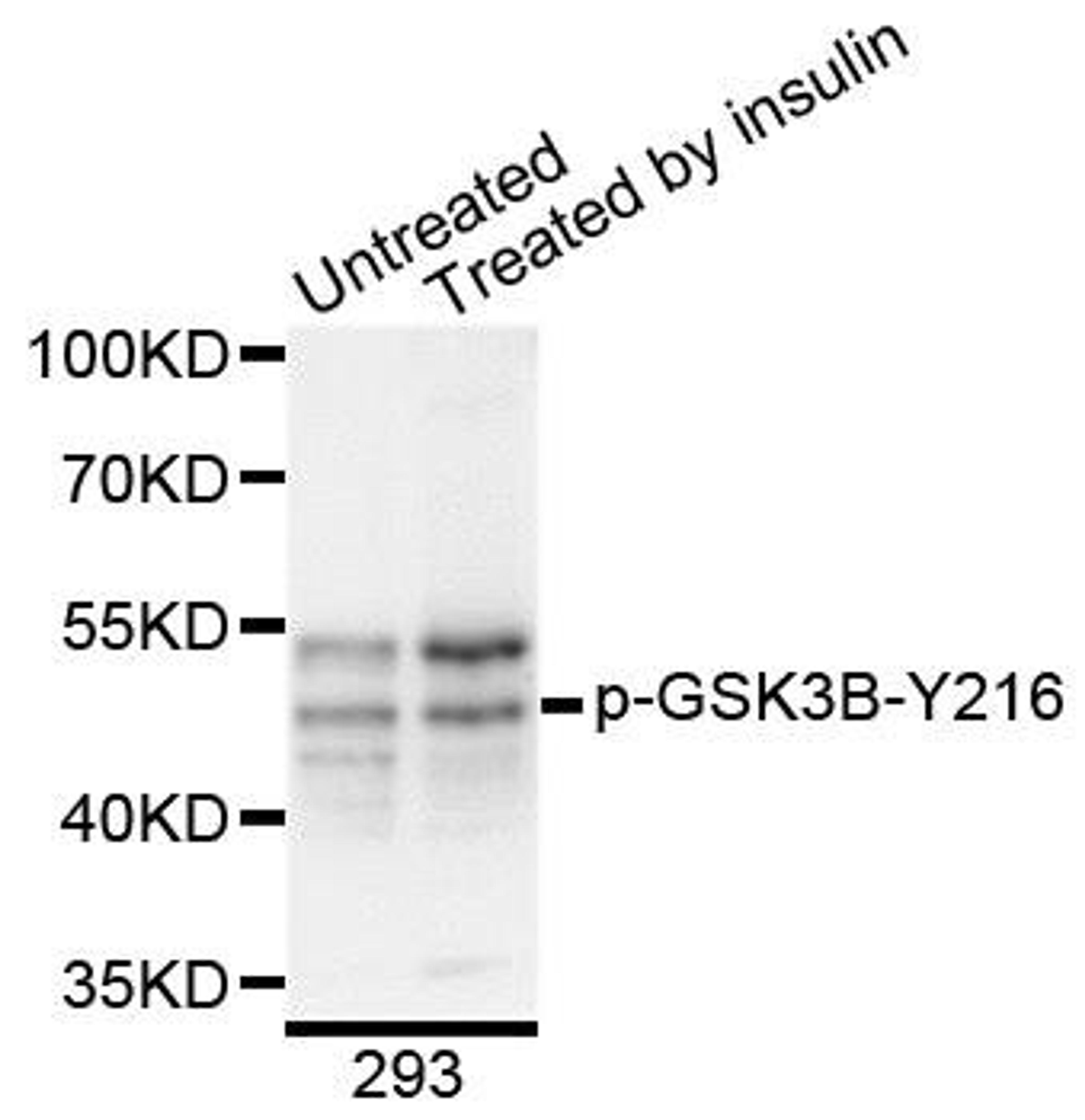 Western blot analysis of extracts of 293 cells using GSK3B (Phospho-Y216) antibody