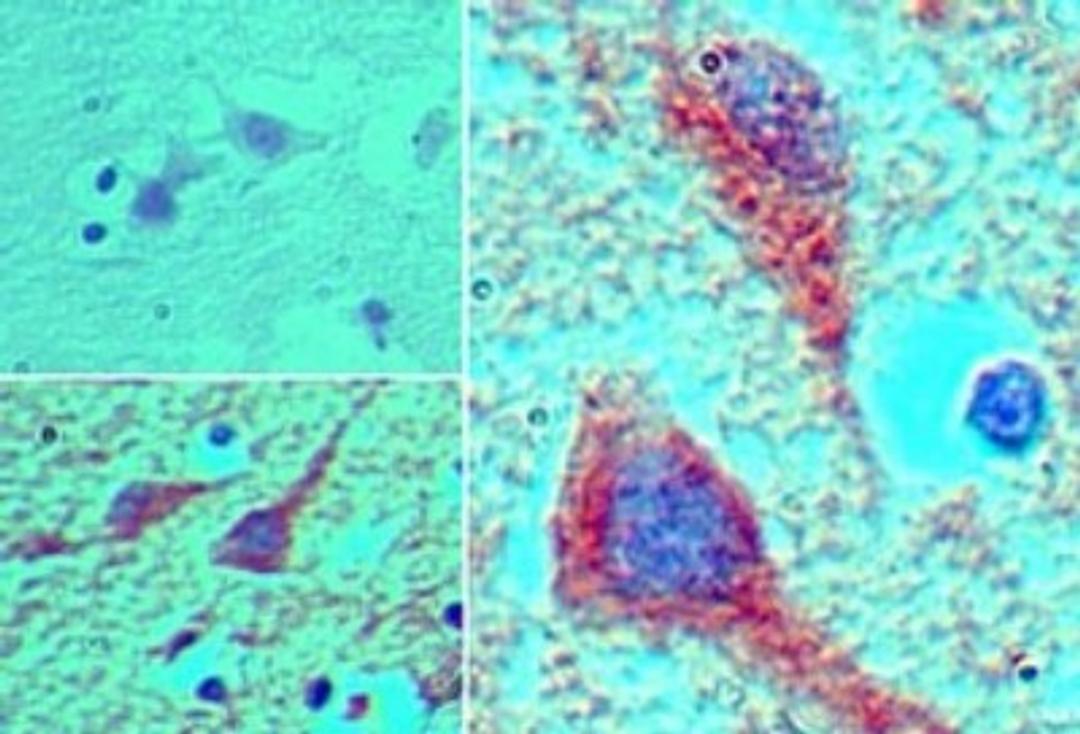 Immunohistochemistry-Paraffin: MEIS1 Antibody [NBP2-24597] - Analysis of MEIS1 in formalin-fixed, paraffin-embedded human brain tissue using an isotype control (top left) and this antibody (bottom left, right) at 5 ug/ml.