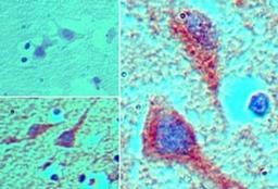 Immunohistochemistry-Paraffin: MEIS1 Antibody [NBP2-24597] - Analysis of MEIS1 in formalin-fixed, paraffin-embedded human brain tissue using an isotype control (top left) and this antibody (bottom left, right) at 5 ug/ml.