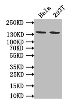 Western Blot. Positive WB detected in: Hela whole cell lysate, 293T whole cell lysate. All lanes: EBI3 antibody at 1:1000. Secondary. Goat polyclonal to rabbit IgG at 1/50000 dilution. Predicted band size: 140 kDa. Observed band size: 140 kDa. 