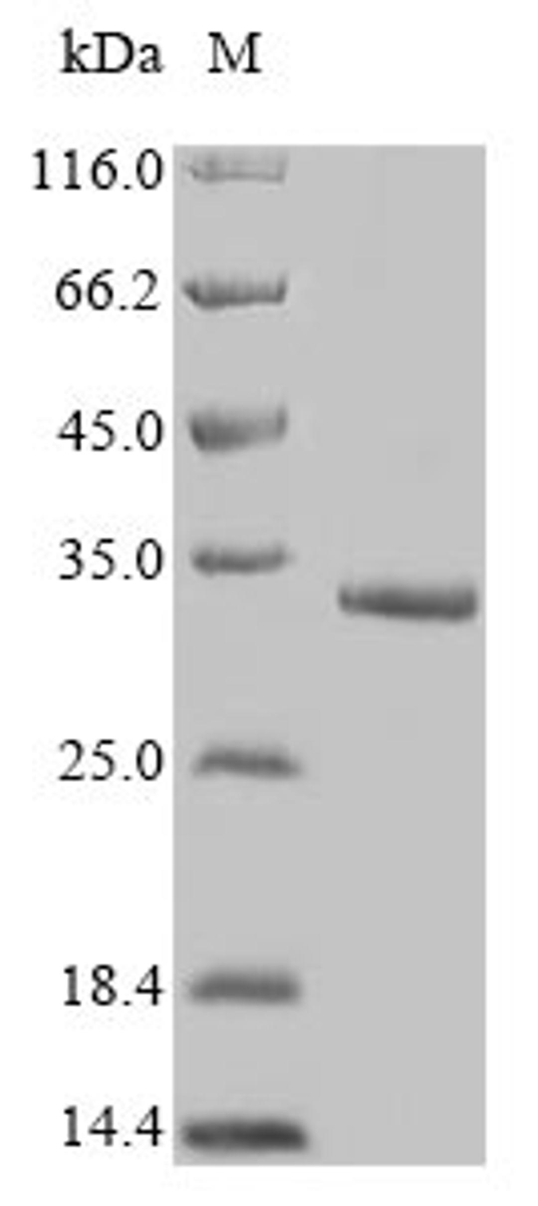 (Tris-Glycine gel) Discontinuous SDS-PAGE (reduced) with 5% enrichment gel and 15% separation gel.