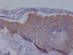 IHC image of CSB-RA194531A0HU diluted at 1:100 and staining in paraffin-embedded human skin tissue performed on a Leica BondTM system. After dewaxing and hydration, antigen retrieval was mediated by high pressure in a citrate buffer (pH 6.0). Section was blocked with 10% normal goat serum 30min at RT. Then primary antibody (1% BSA) was incubated at 4°C overnight. The primary is detected by a Goat anti-rabbit polymer IgG labeled by HRP and visualized using 0.05% DAB.