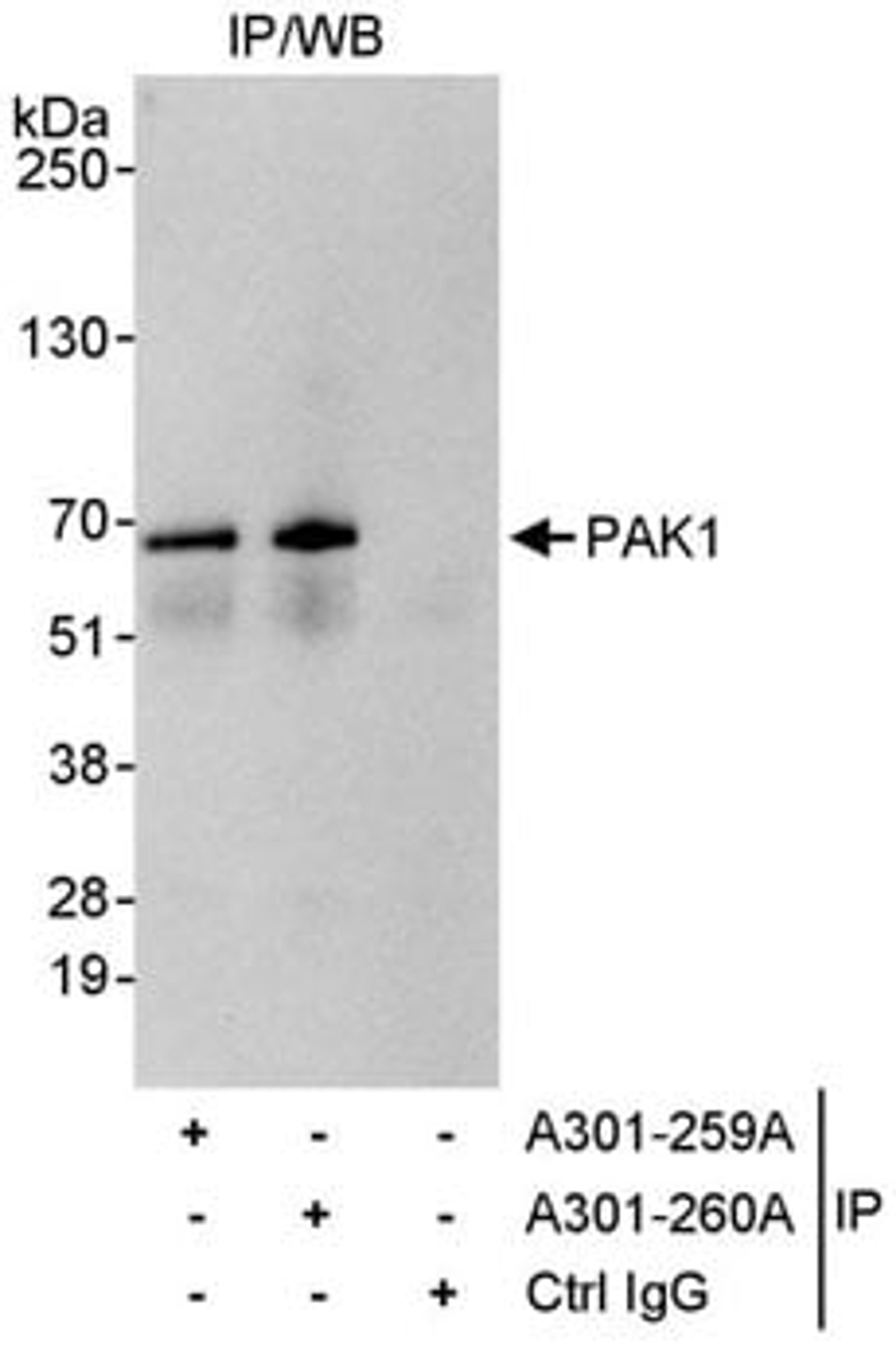 Detection of human PAK1 by western blot of immunoprecipitates.