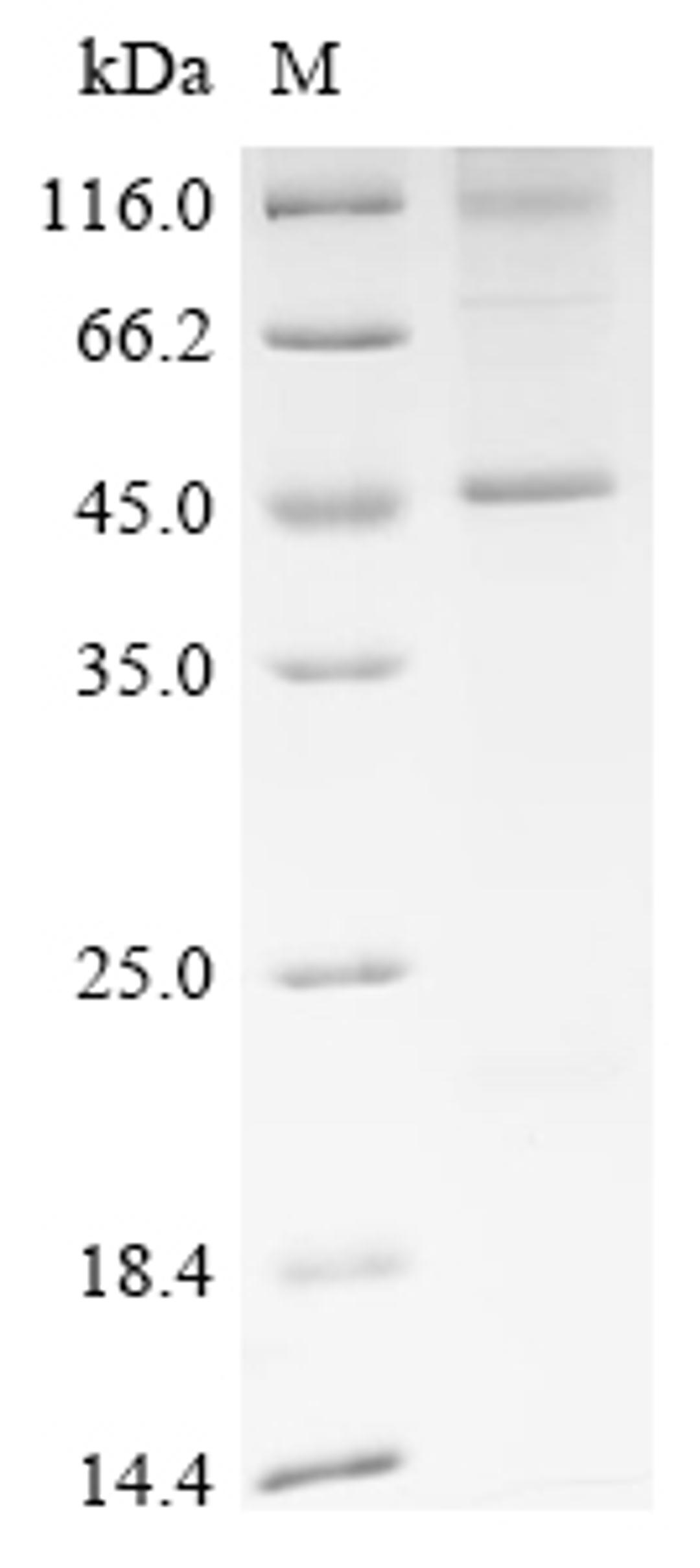(Tris-Glycine gel) Discontinuous SDS-PAGE (reduced) with 5% enrichment gel and 15% separation gel.