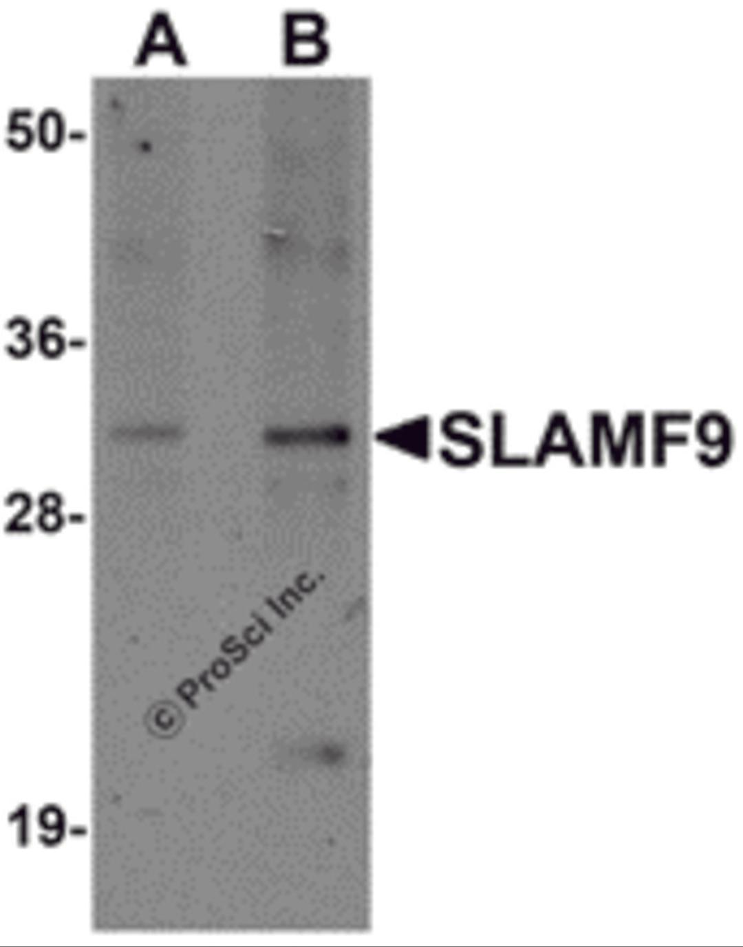 Western blot analysis of SLAMF9 in mouse kidney tissue lysate with SLAMF9 antibody at (A) 1 and (B) 2 &#956;g/mL.