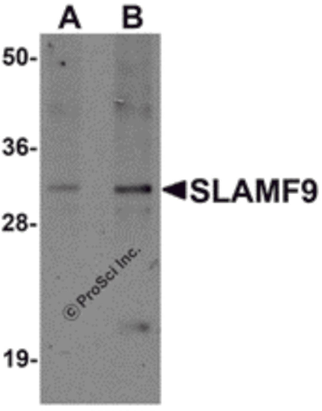 Western blot analysis of SLAMF9 in mouse kidney tissue lysate with SLAMF9 antibody at (A) 1 and (B) 2 μg/mL.