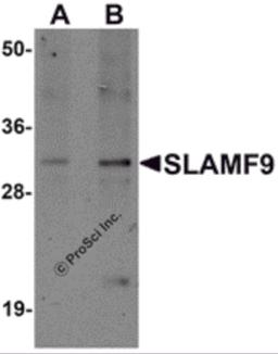 Western blot analysis of SLAMF9 in mouse kidney tissue lysate with SLAMF9 antibody at (A) 1 and (B) 2 μg/mL.