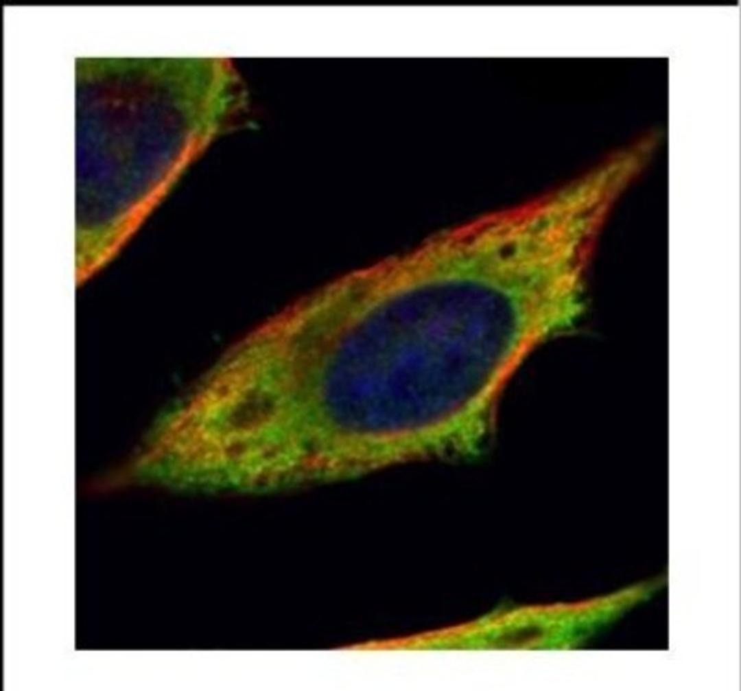 Immunocytochemistry/Immunofluorescence: Calpain 11 Antibody [NBP2-15673] - Confocal immunofluorescence analysis of methanol-fixed HeLa, using Calpain 11 antibody (Green) at 1:200 dilution. Alpha-tubulin filaments are labeled with Alpha-tubulin antibody (Red) at 1:2000.