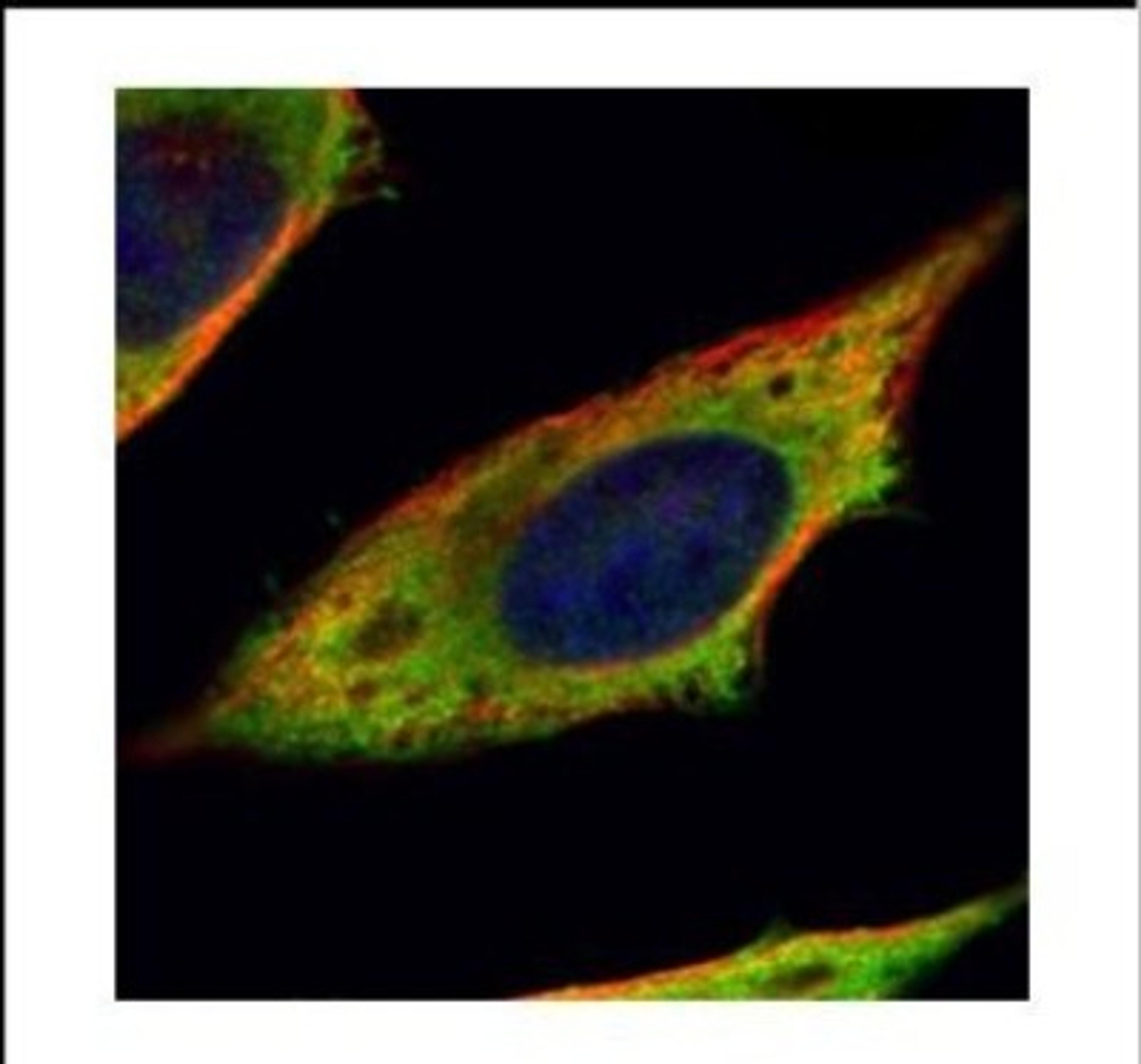 Immunocytochemistry/Immunofluorescence: Calpain 11 Antibody [NBP2-15673] - Confocal immunofluorescence analysis of methanol-fixed HeLa, using Calpain 11 antibody (Green) at 1:200 dilution. Alpha-tubulin filaments are labeled with Alpha-tubulin antibody (Red) at 1:2000.