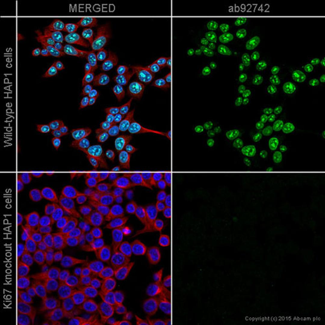 Immunocytochemistry/ Immunofluorescence - Anti-Ki67 antibody [EPR3610] 