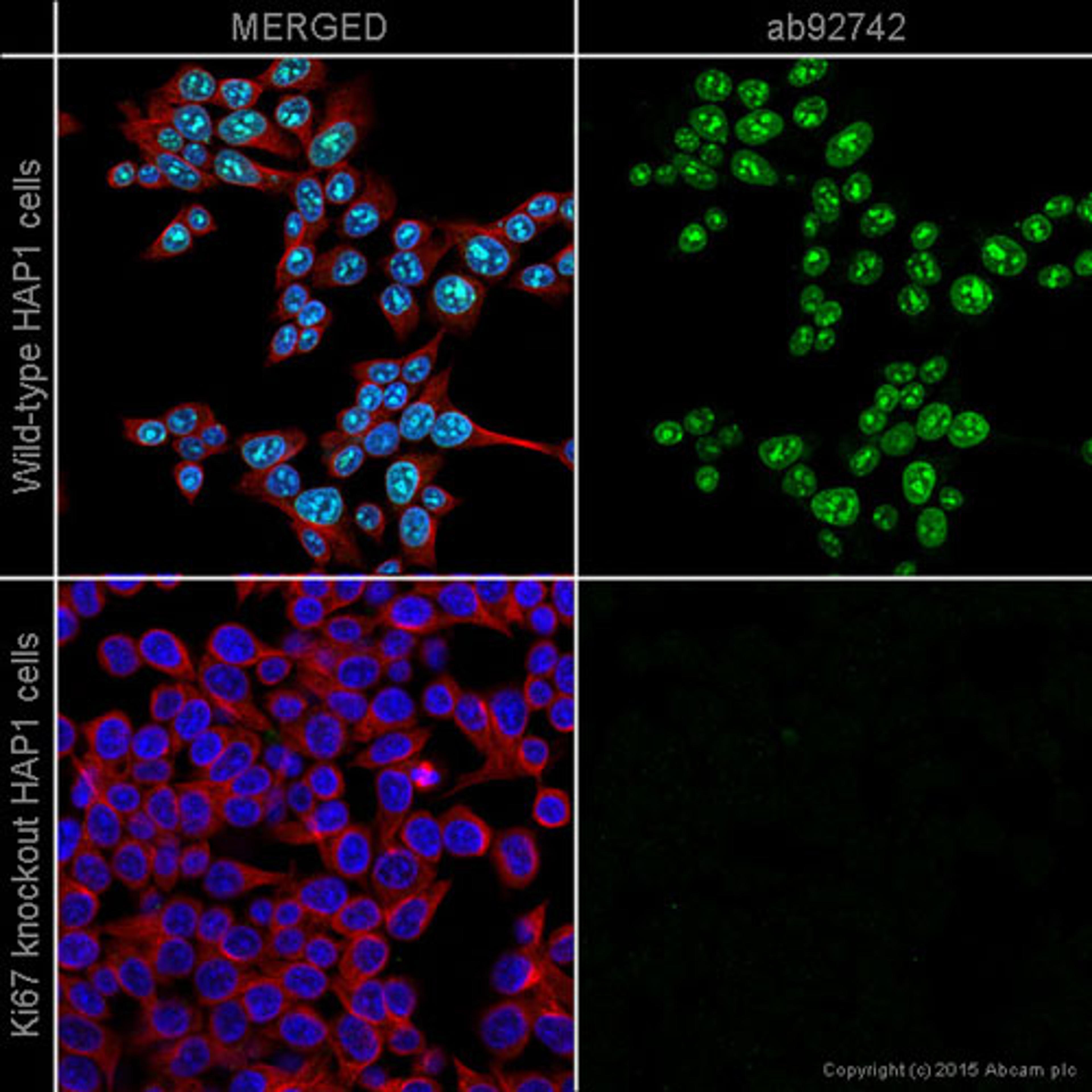 Immunocytochemistry/ Immunofluorescence - Anti-Ki67 antibody [EPR3610] 