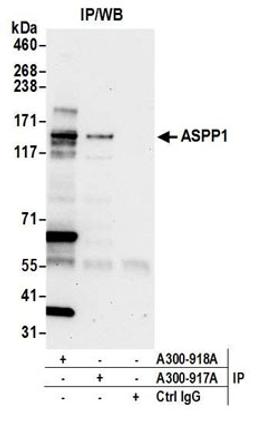 Detection of human ASPP1 by western blot of immunoprecipitates.