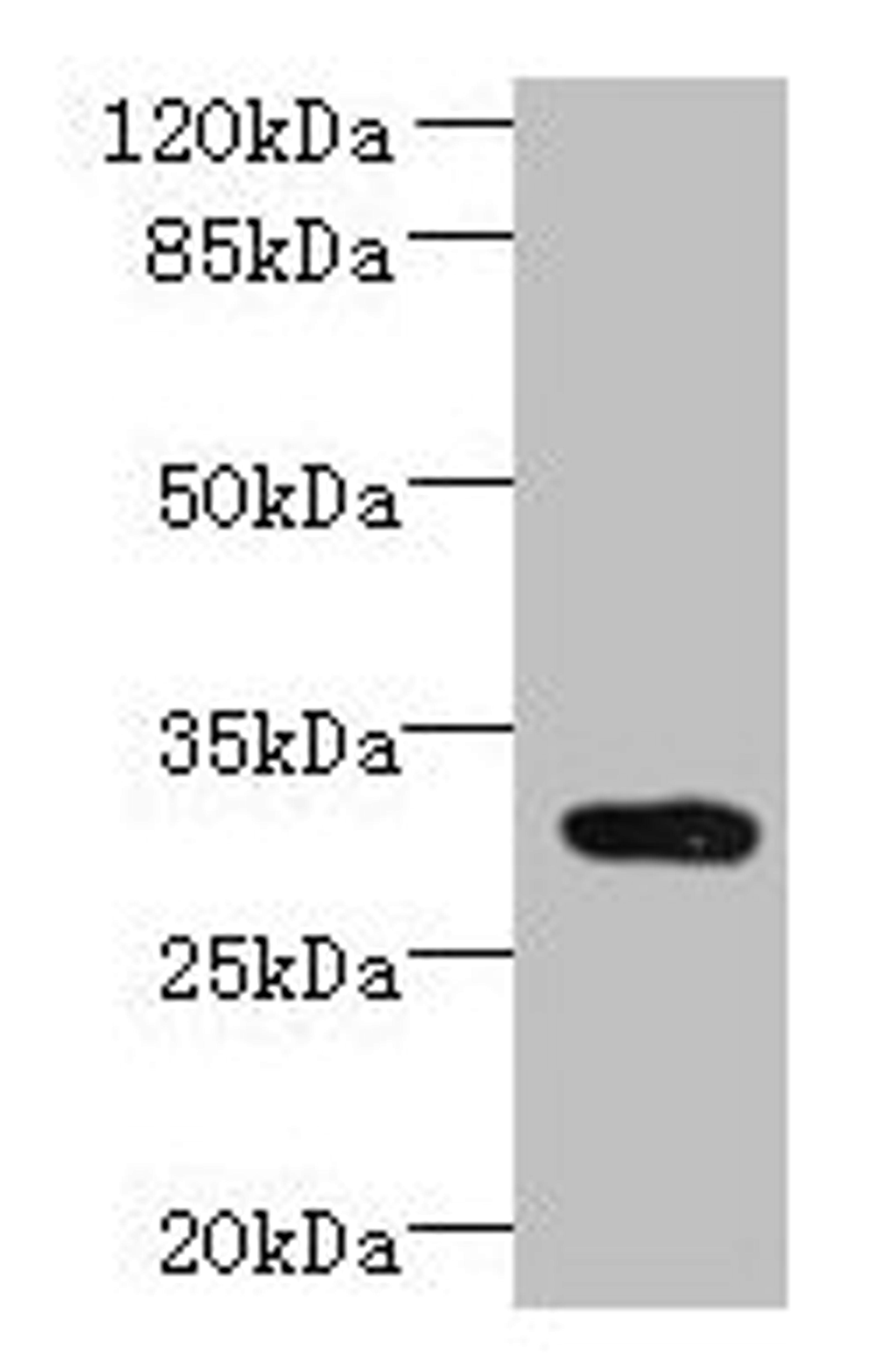Western blot. All lanes: CCDC127 antibody at 6µg/ml + Mouse kidney tissue. Secondary. Goat polyclonal to rabbit IgG at 1/10000 dilution. Predicted band size: 31 kDa. Observed band size: 31 kDa