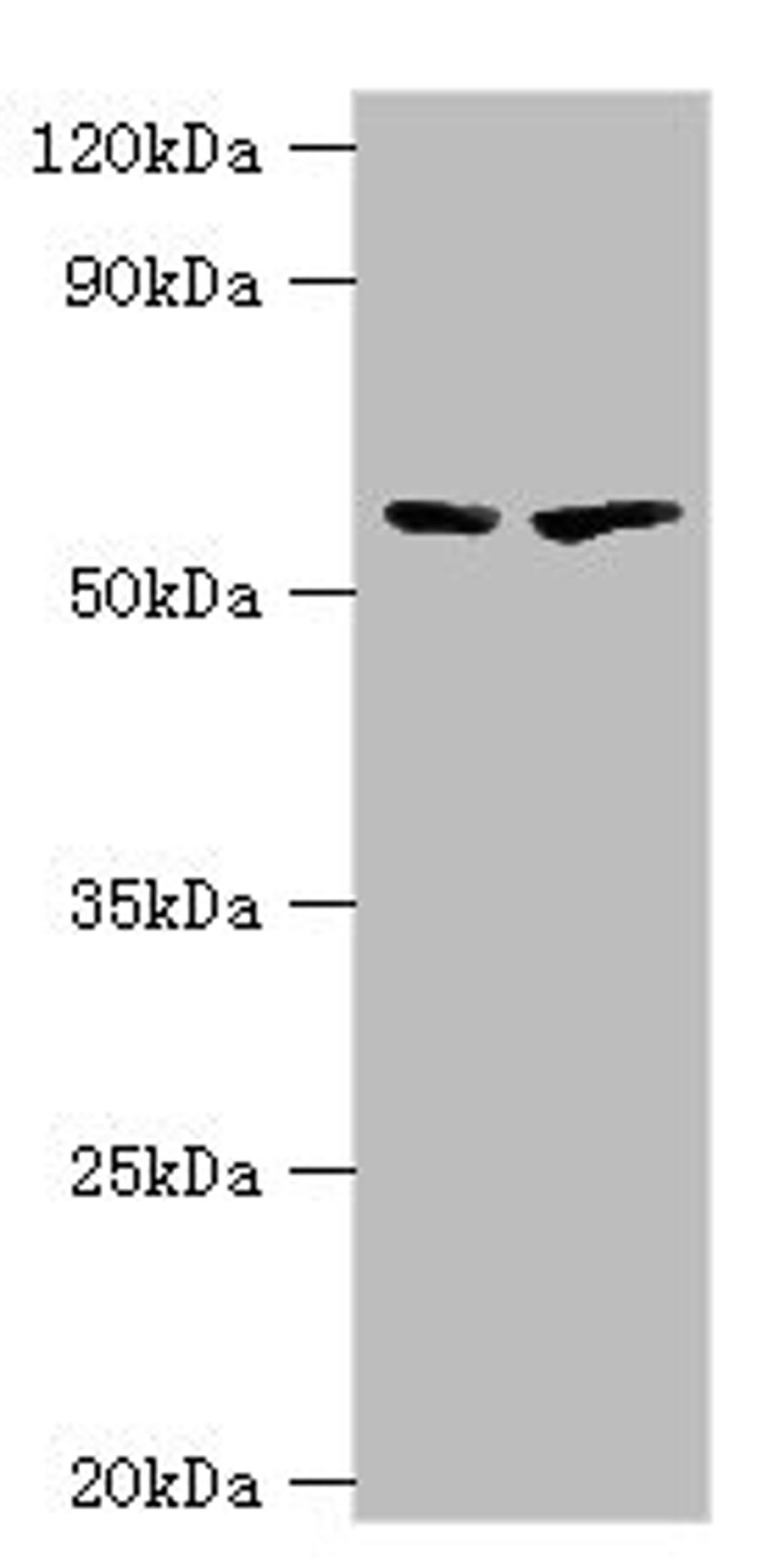 Western blot. All lanes: 5-aminolevulinate synthase, erythroid-specific, mitochondrial antibody at 7ug/ml. Lane 1: 293T whole cell lysate. Lane 2: Mouse brain tissue. Secondary. Goat polyclonal to rabbit IgG at 1/10000 dilution. Predicted band size: 65, 61, 50, 64 kDa. Observed band size: 65 kDa.