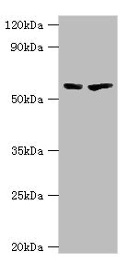 Western blot. All lanes: 5-aminolevulinate synthase, erythroid-specific, mitochondrial antibody at 7ug/ml. Lane 1: 293T whole cell lysate. Lane 2: Mouse brain tissue. Secondary. Goat polyclonal to rabbit IgG at 1/10000 dilution. Predicted band size: 65, 61, 50, 64 kDa. Observed band size: 65 kDa.