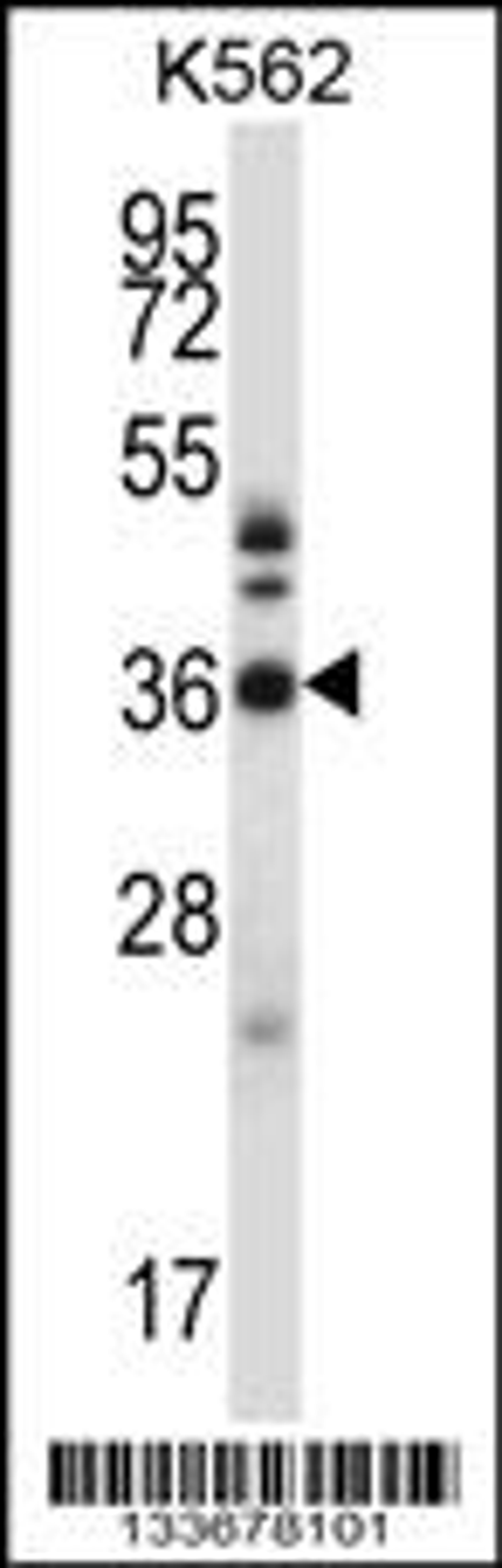 Western blot analysis in K562 cell line lysates (35ug/lane).