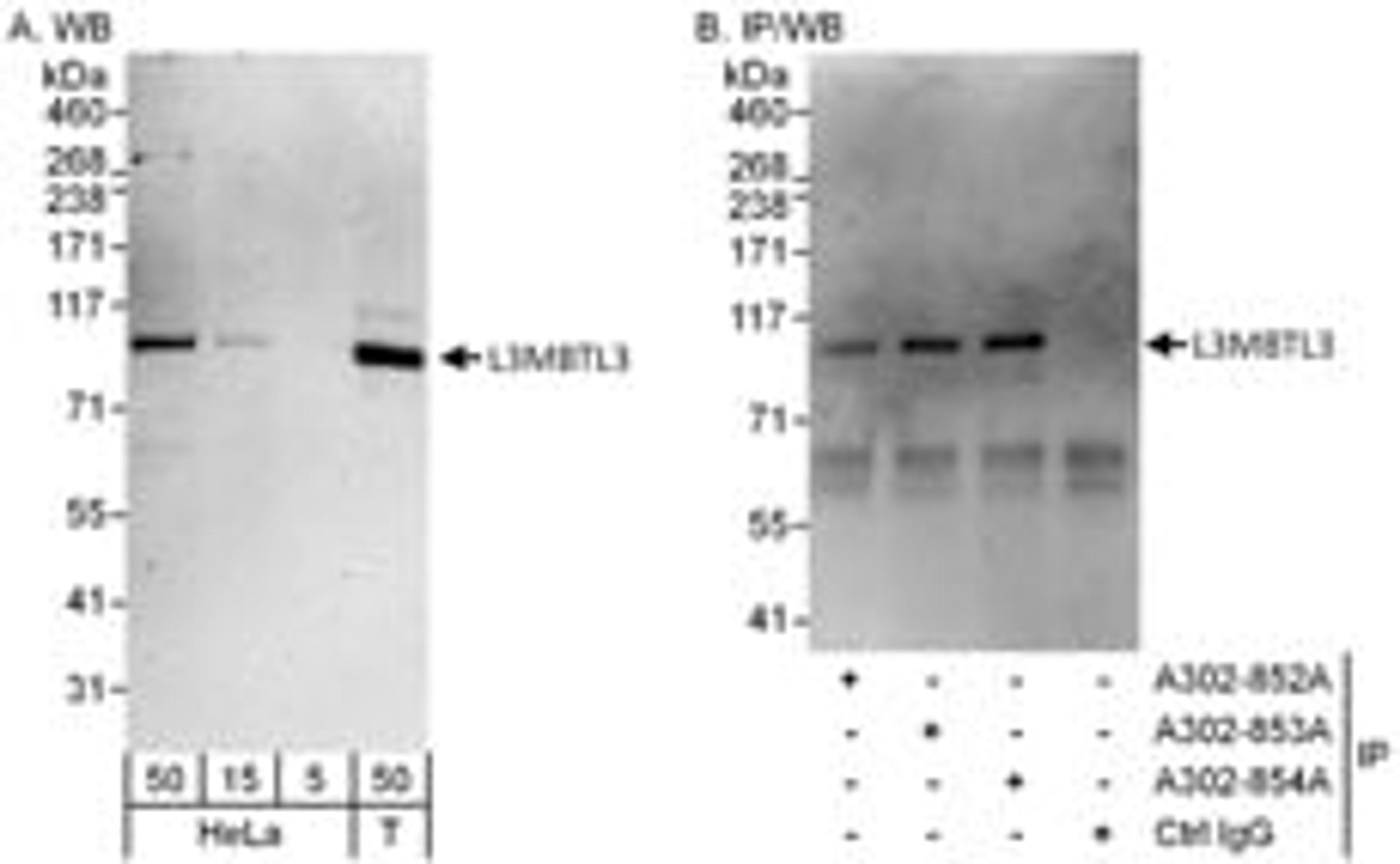 Detection of human L3MBTL3 by western blot and immunoprecipitation.