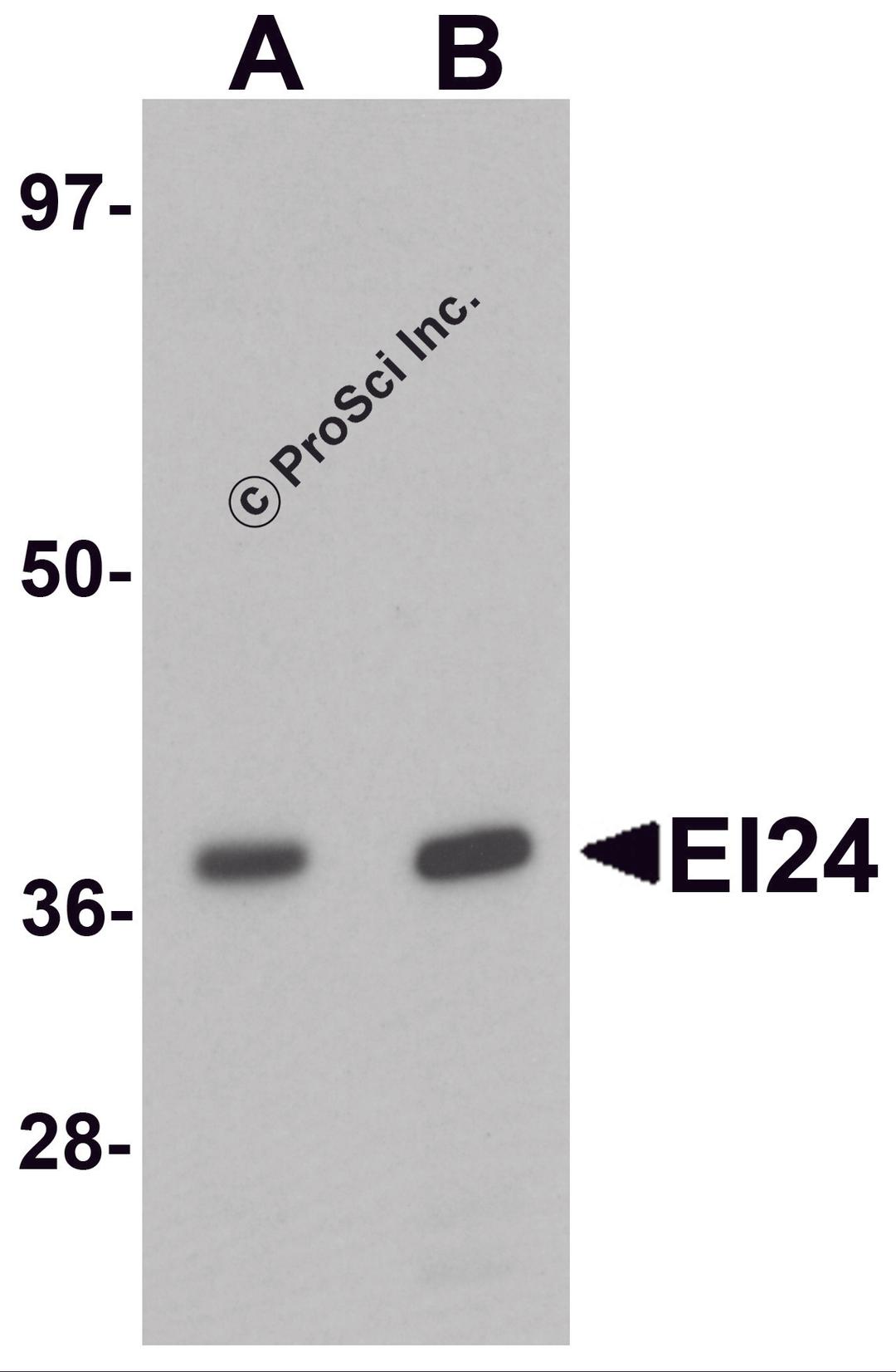 Western blot analysis of EI24 in rat liver tissue lysate with EI24 antibody at (A) 1 and (B) 2 μg/mL.