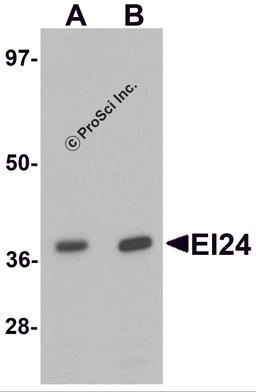 Western blot analysis of EI24 in rat liver tissue lysate with EI24 antibody at (A) 1 and (B) 2 μg/mL.