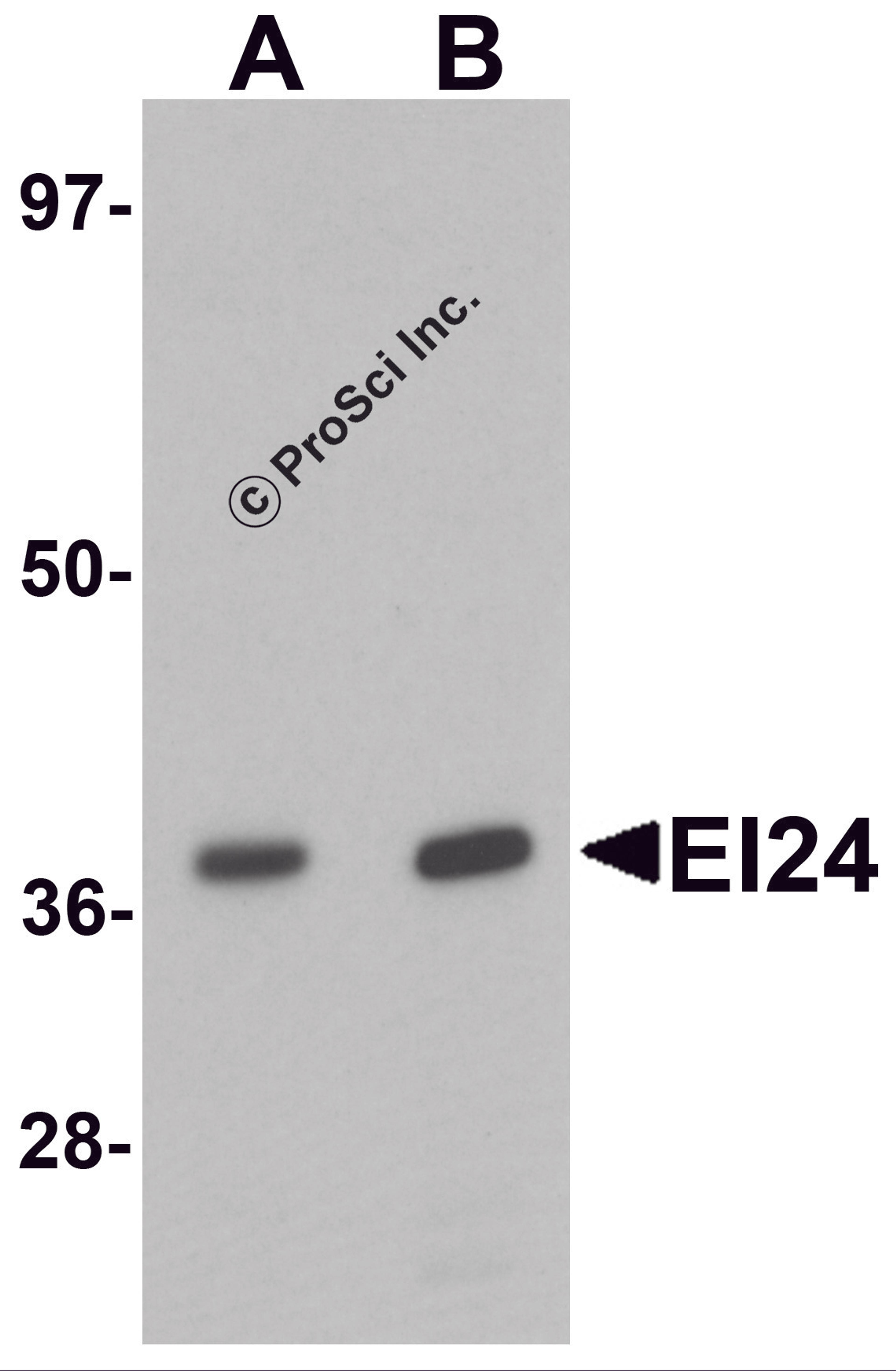 Western blot analysis of EI24 in rat liver tissue lysate with EI24 antibody at (A) 1 and (B) 2 μg/mL.