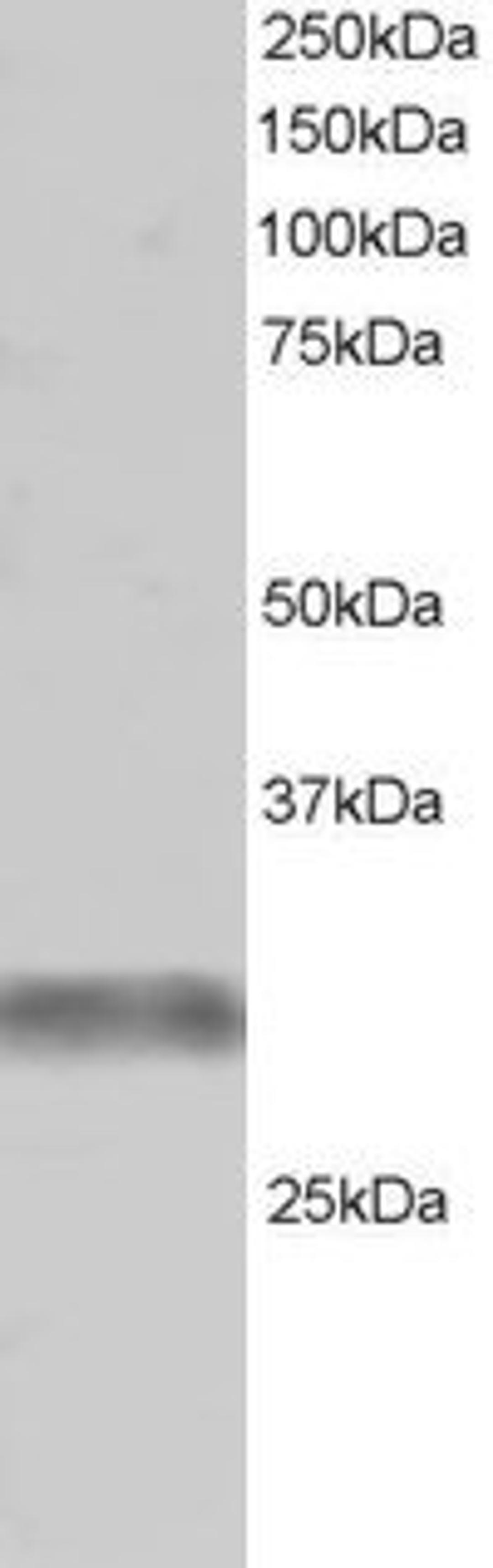 45-684 (1ug/ml) staining of Human Skeletal Muscle lysate (RIPA buffer, 30ug total protein per lane). Primary incubated for 1 hour. Detected by western blot using chemiluminescence.