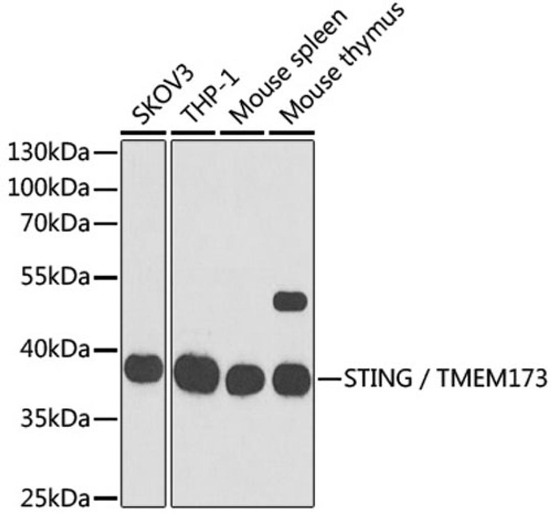 Western blot - STING / TMEM173 antibody (A3575)