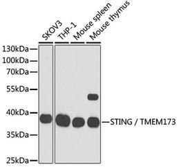 Western blot - STING / TMEM173 antibody (A3575)