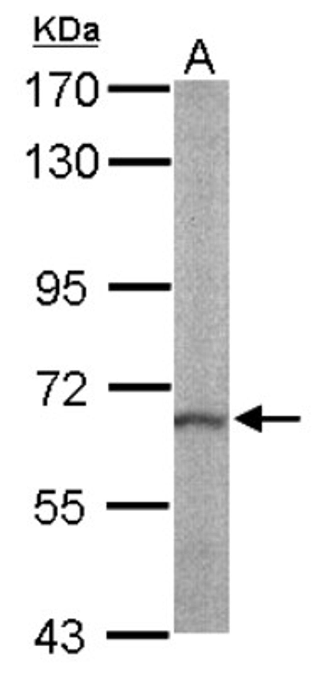 Western Blot: RASGRP2 Antibody [NBP1-33315] - Sample (50 ug of whole cell lysate) A: mouse liver 7.5% SDS PAGE; antibody diluted at 1:1000.