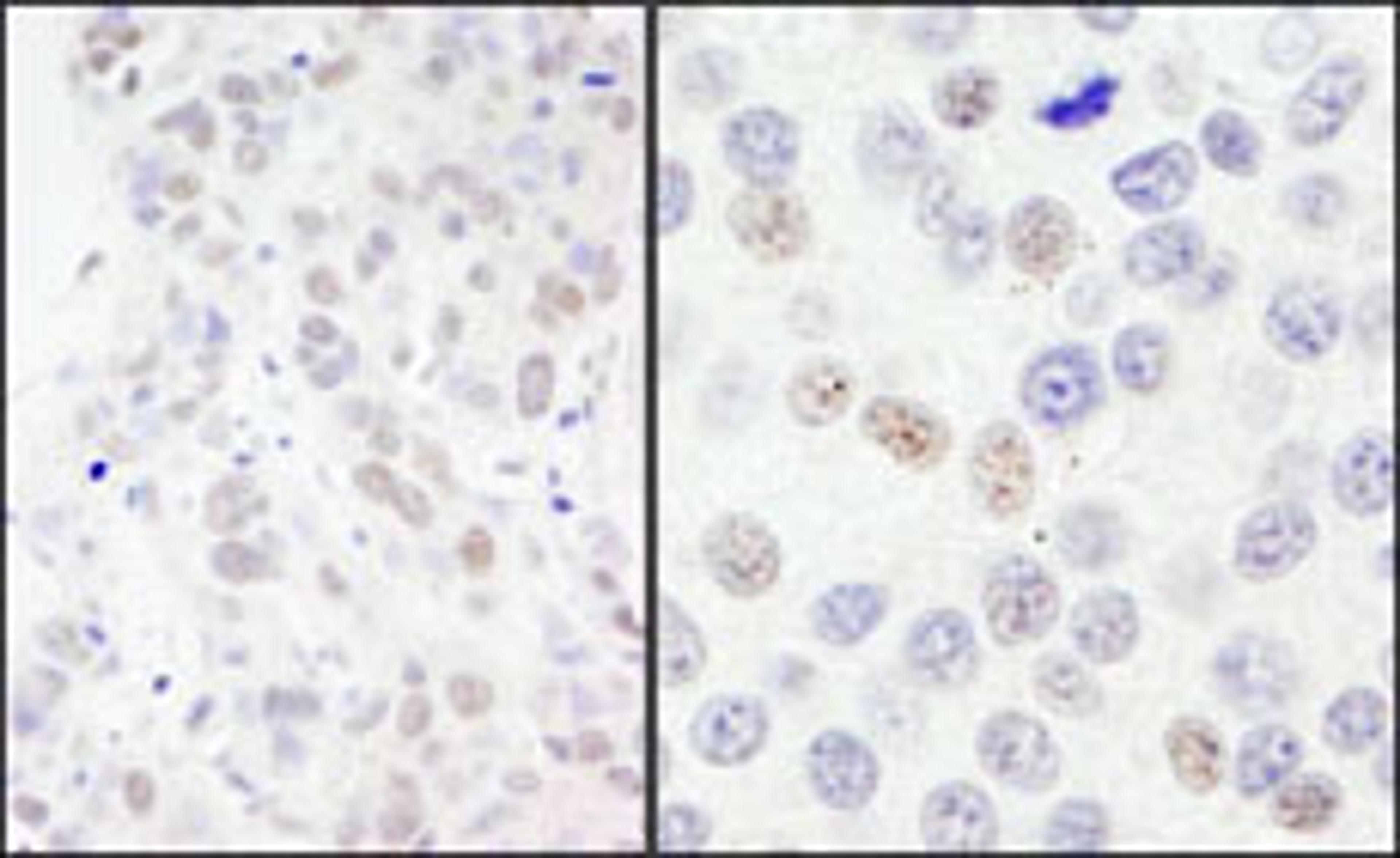 Detection of human NBS1 by immunohistochemistry.