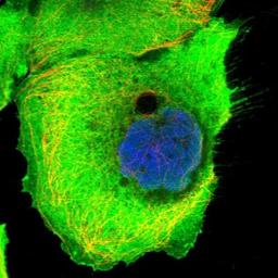 Immunocytochemistry/Immunofluorescence: Lactate Dehydrogenase C Antibody [NBP1-92065] - Staining of human cell line A-431 shows positivity in plasma membrane.