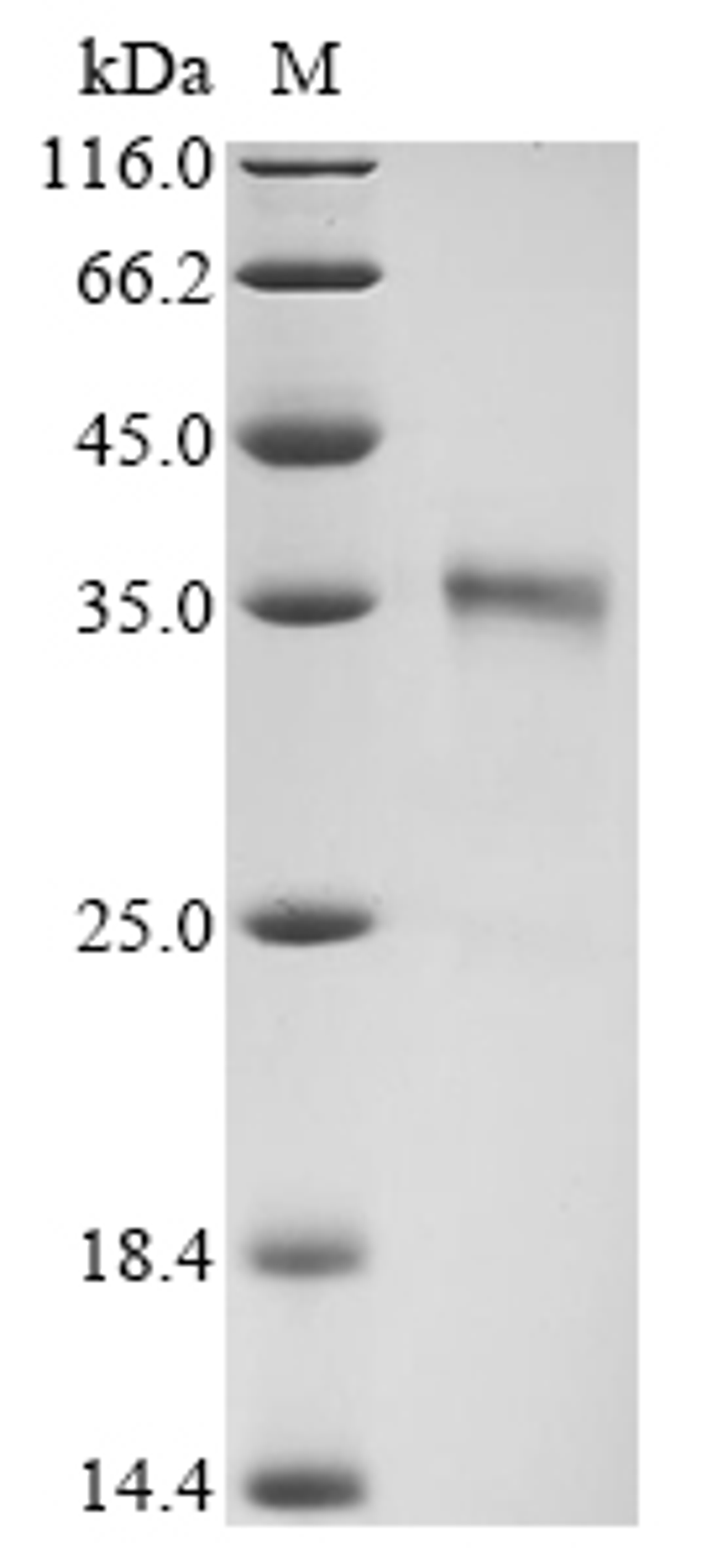 (Tris-Glycine gel) Discontinuous SDS-PAGE (reduced) with 5% enrichment gel and 15% separation gel.