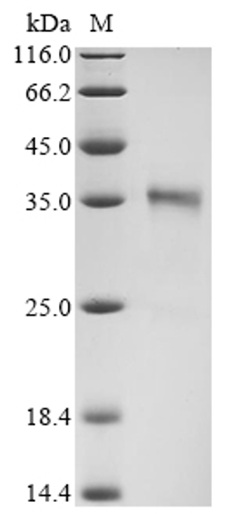 (Tris-Glycine gel) Discontinuous SDS-PAGE (reduced) with 5% enrichment gel and 15% separation gel.