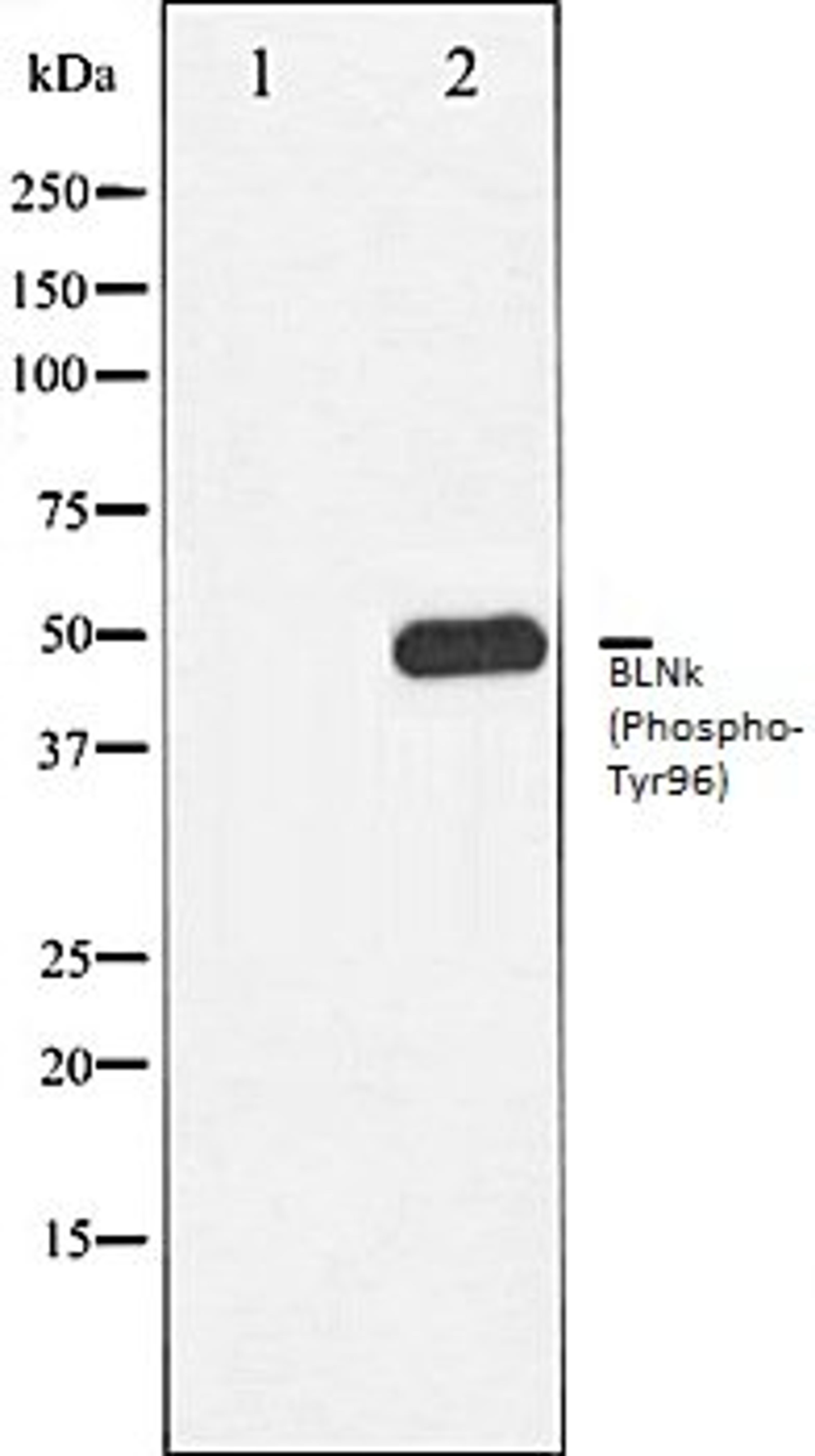 Western blot analysis of COLO205 whole cell lysates using BLNK (Phospho-Tyr96) antibody, The lane on the left is treated with the antigen-specific peptide.