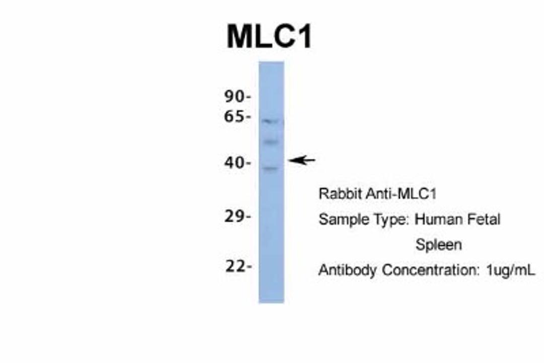 Western Blot: MLC1 Antibody [NBP1-80073] - Human Fetal Spleen, Antibody Dilution: 1.0 ug/ml.