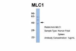 Western Blot: MLC1 Antibody [NBP1-80073] - Human Fetal Spleen, Antibody Dilution: 1.0 ug/ml.