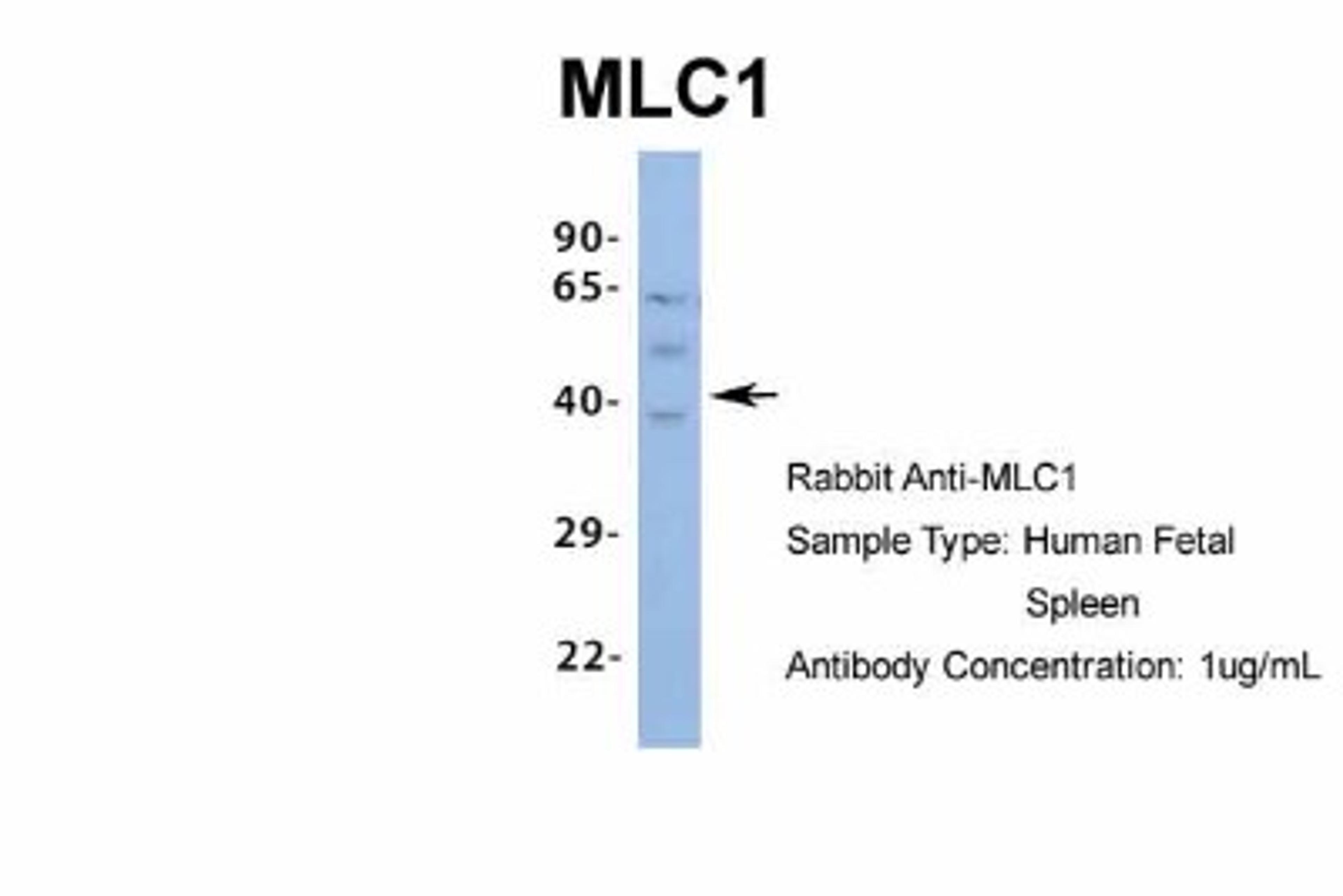 Western Blot: MLC1 Antibody [NBP1-80073] - Human Fetal Spleen, Antibody Dilution: 1.0 ug/ml.