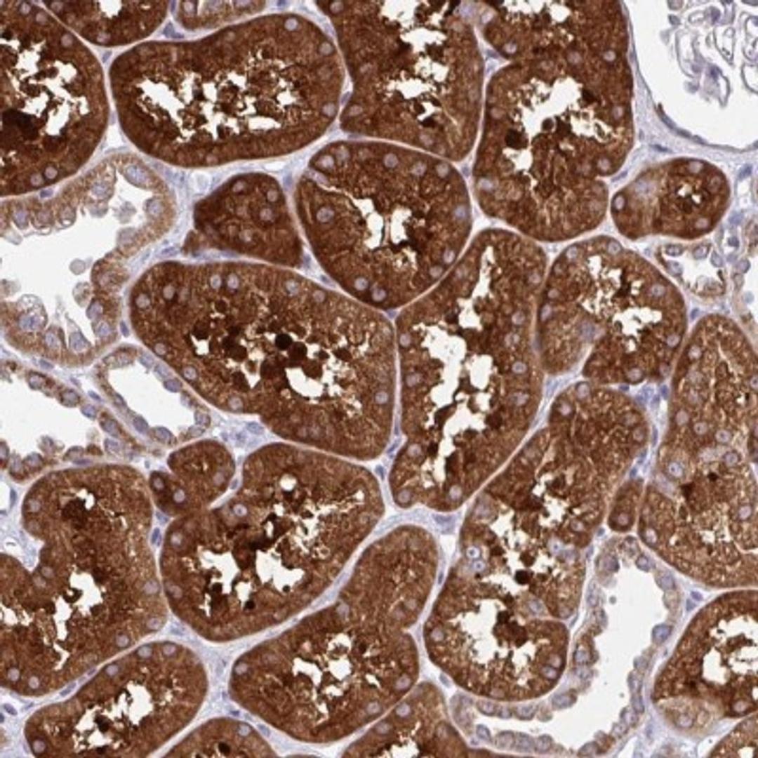 Immunohistochemistry: TCEAL2 Antibody [NBP2-32419] - Staining of human kidney shows strong cytoplasmic positivity in tubular cells.