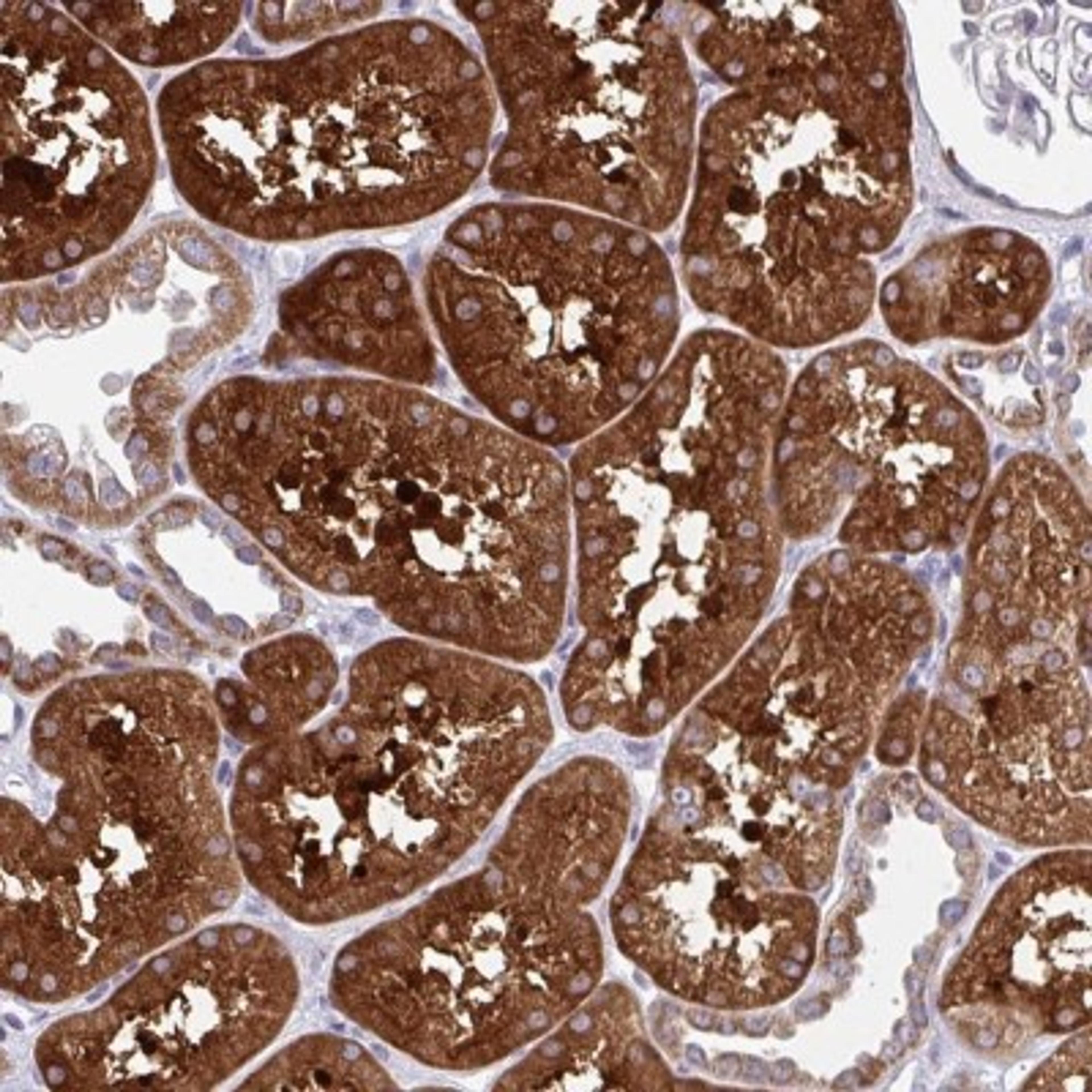 Immunohistochemistry: TCEAL2 Antibody [NBP2-32419] - Staining of human kidney shows strong cytoplasmic positivity in tubular cells.